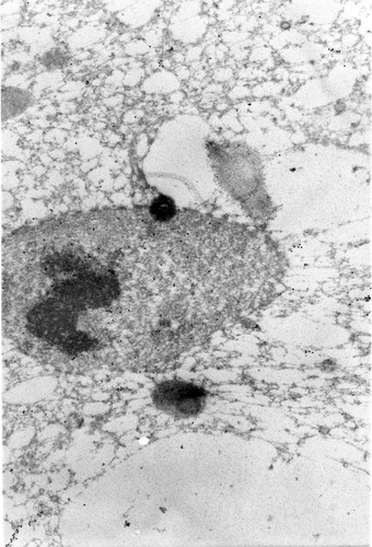 CIL:1311, Paramecium tetraurelia, cell by organism, eukaryotic cell, Eukaryotic Protist, Ciliated Protist