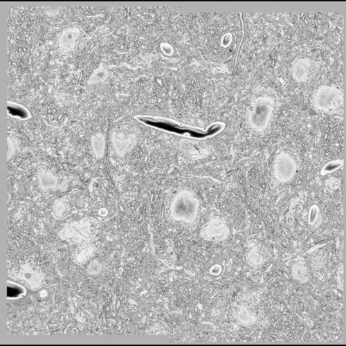 CIL:50582, MiniSOG+ ipRGC axon labeling in the olivary pretectal nucleus (OPN)