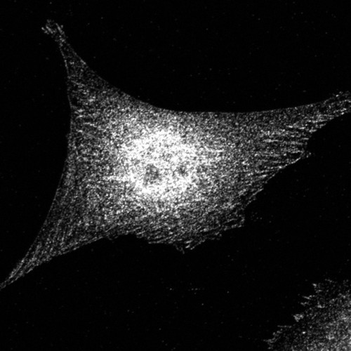 CIL:26535, Mus musculus, fibroblast