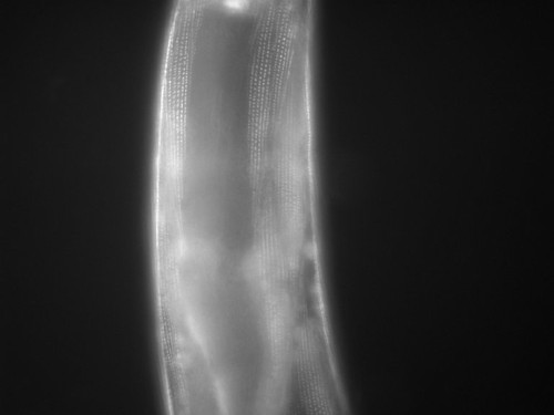 CIL:1128, Caenorhabditis elegans, muscle cell