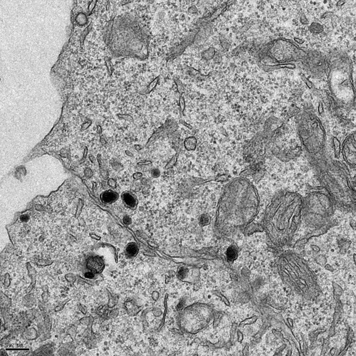 CIL:13762, Rattus norvegicus, pheochromocytoma, adrenal gland cell