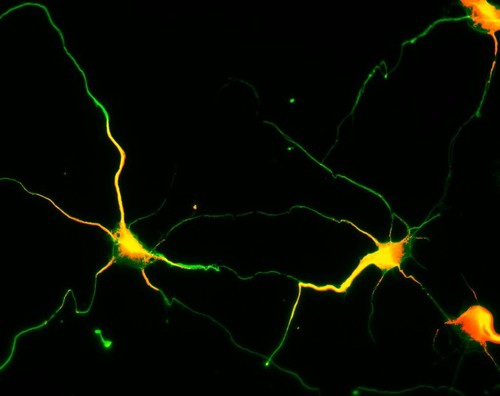 CIL:8271, Rattus, multipolar neuron