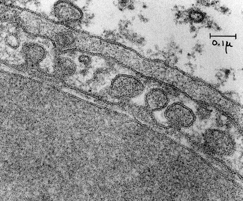 CIL:37125, Mus musculus, endothelial cell