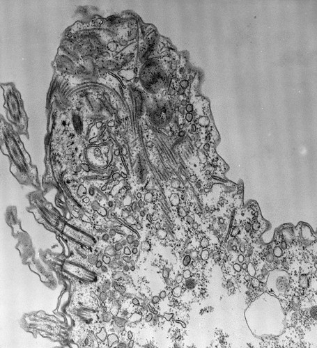 CIL:39165, Paramecium caudatum, cell by organism, eukaryotic cell, Eukaryotic Protist, Ciliated Protist