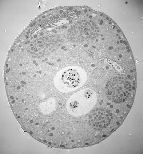 CIL:39404, Vorticella convallaria, cell by organism, eukaryotic cell, Eukaryotic Protist, Ciliated Protist