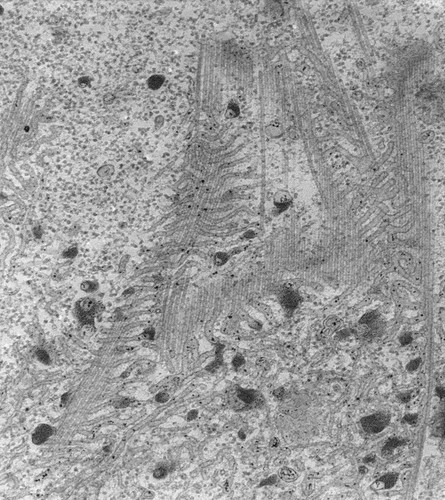 CIL:13115, Paramecium multimicronucleatum, cell by organism, eukaryotic cell, Eukaryotic Protist, Ciliated Protist