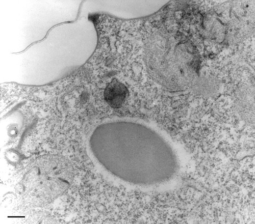 CIL:17443, Paramecium multimicronucleatum, cell by organism, eukaryotic cell, Eukaryotic Protist, Ciliated Protist