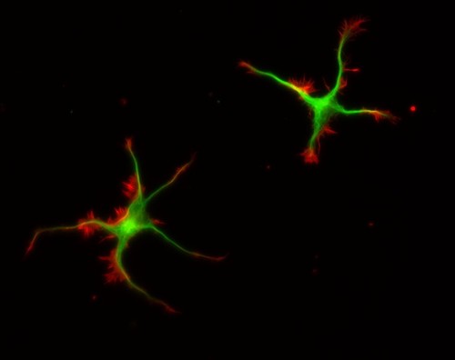 CIL:8779, Rattus, multipolar neuron