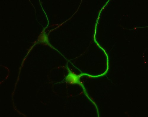 CIL:10266, Rattus, multipolar neuron