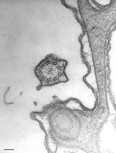 CIL:36757, Paramecium caudatum, cell by organism, eukaryotic cell, Eukaryotic Protist, Ciliated Protist