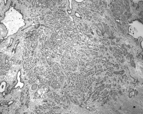 CIL:33673, Homo sapiens, endocrine-paracrine cell of prostate gland, basal cell of prostate epithelium, luminal cell of prostate epithelium, blood vessel endothelial cell, perineural cell, sheath cell, leukocyte, prostate stromal cell, smooth muscle cell of prostate