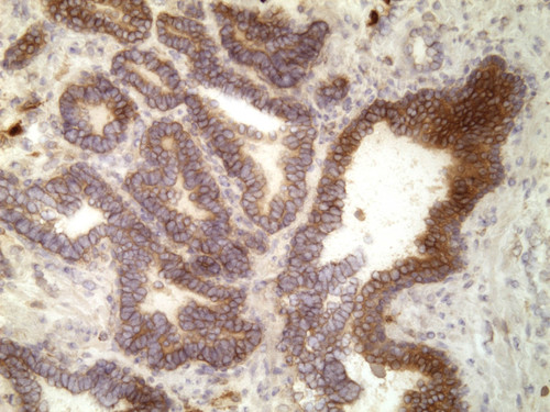 CIL:33156, Homo sapiens, endocrine-paracrine cell of prostate gland, basal cell of prostate epithelium, luminal cell of prostate epithelium, blood vessel endothelial cell, perineural cell, sheath cell, leukocyte, prostate stromal cell, smooth muscle cell of prostate