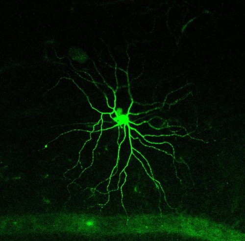 CIL:57182, Mus musculus, multipolar neuron; M2 melanopsin retinal ganglion cell