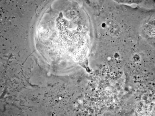 CIL:24576, Balamuthia mandrillaris, cell by organism, eukaryotic cell, Eukaryotic Protist, Amoeboid Protist