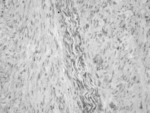 CIL:33915, Homo sapiens, endocrine-paracrine cell of prostate gland, basal cell of prostate epithelium, luminal cell of prostate epithelium, blood vessel endothelial cell, perineural cell, sheath cell, leukocyte, prostate stromal cell, smooth muscle cell of prostate