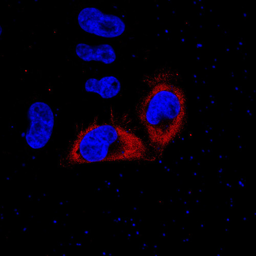 CIL: 53806, Homo sapiens, HeLa