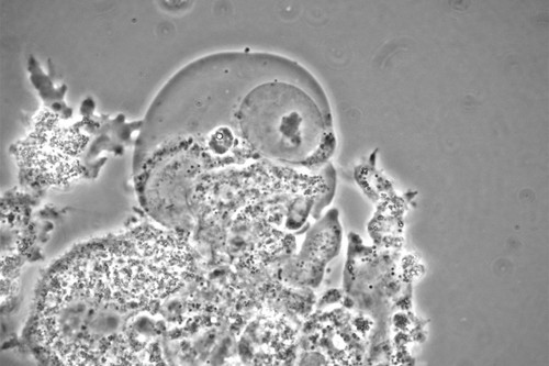 CIL:24567, Balamuthia mandrillaris, cell by organism, eukaryotic cell, Eukaryotic Protist, Amoeboid Protist