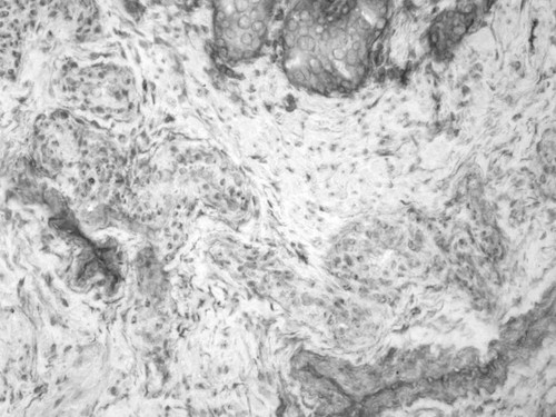 CIL:34035, Homo sapiens, endocrine-paracrine cell of prostate gland, basal cell of prostate epithelium, luminal cell of prostate epithelium, blood vessel endothelial cell, perineural cell, sheath cell, leukocyte, prostate stromal cell, smooth muscle cell of prostate