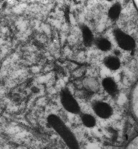 CIL:13122, Paramecium multimicronucleatum, cell by organism, eukaryotic cell, Eukaryotic Protist, Ciliated Protist