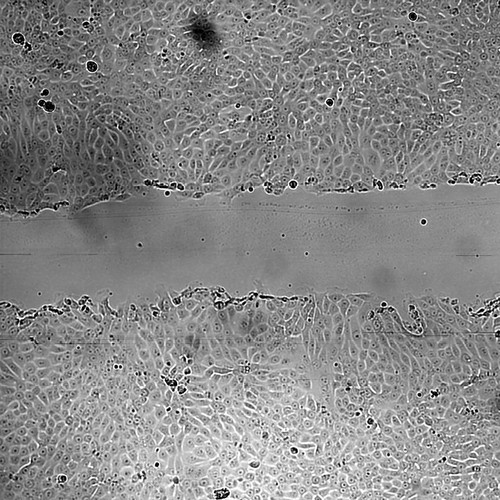 CIL:43406, Mus musculus, mammary adenocarcinoma