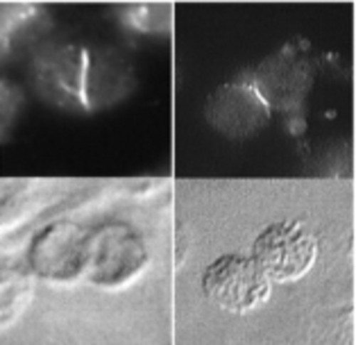 CIL:38856, Arabidopsis thaliana, leaf