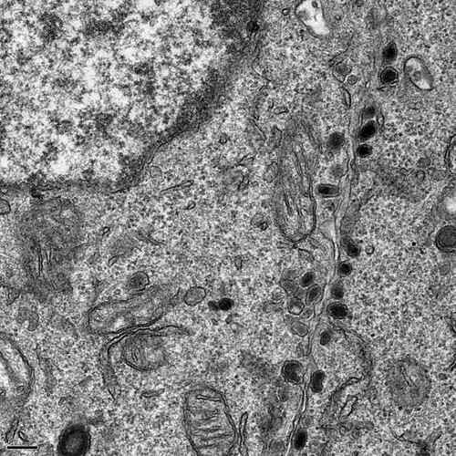 CIL:13761, Rattus norvegicus, pheochromocytoma, adrenal gland cell