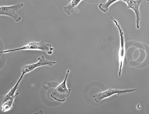 CIL:25692, Homo sapiens, retinal pigment epithelium