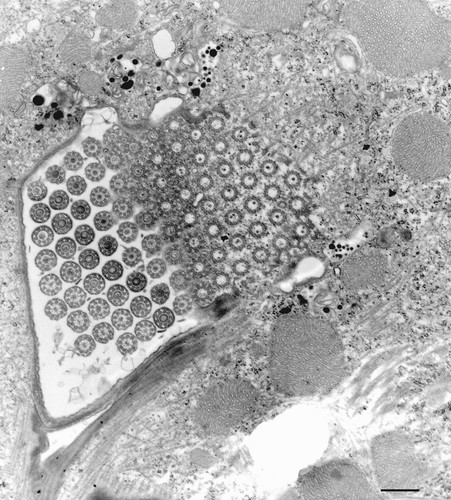 CIL:9908, Euplotes sp., cell by organism, eukaryotic cell, Eukaryotic Protist, Ciliated Protist