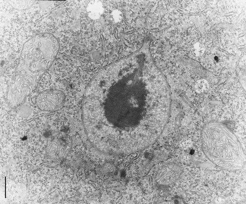 CIL:10006, Didinium nasutum, cell by organism, eukaryotic cell, Eukaryotic Protist, Ciliated Protist