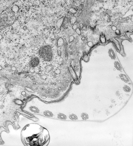 CIL:39508, Vorticella convallaria, cell by organism, eukaryotic cell, Eukaryotic Protist, Ciliated Protist