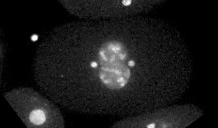 CIL:28776, Caenorhabditis elegans, embryo