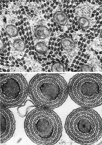 CIL:35965, Cecidomyiinae, Lepidosaphes, sperm