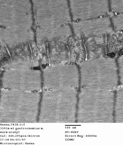 CIL:354, Mus musculus, skeletal muscle cell