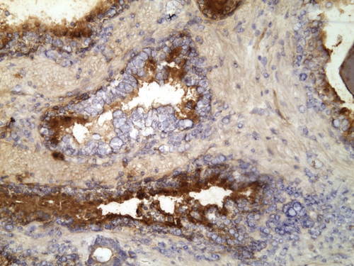 CIL:32181, Homo sapiens, endocrine-paracrine cell of prostate gland, basal cell of prostate epithelium, luminal cell of prostate epithelium, blood vessel endothelial cell, perineural cell, sheath cell, leukocyte, prostate stromal cell, smooth muscle cell of prostate