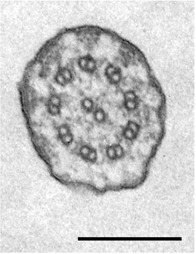 CIL:34619, Tetrahymena pyriformis, cell by organism, eukaryotic cell, Eukaryotic Protist, Ciliated Protist