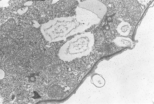 CIL:2861, Colpoda cucullus, cell by organism, eukaryotic cell, Eukaryotic Protist, Ciliated Protist