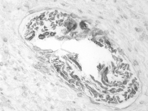 CIL:33562, Homo sapiens, endocrine-paracrine cell of prostate gland, basal cell of prostate epithelium, luminal cell of prostate epithelium, blood vessel endothelial cell, perineural cell, sheath cell, leukocyte, prostate stromal cell, smooth muscle cell of prostate