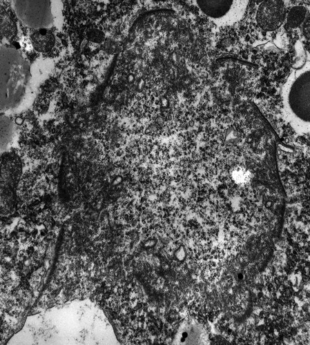 CIL:12995, Paramecium multimicronucleatum, cell by organism, eukaryotic cell, Eukaryotic Protist, Ciliated Protist