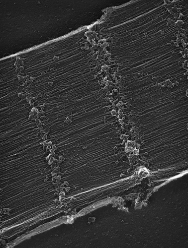 CIL:36019, damselfly, flight muscle cell