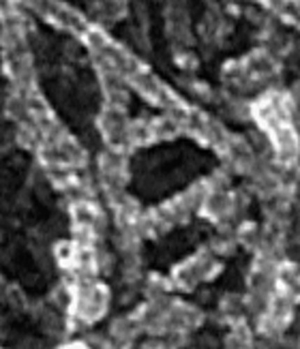 CIL:34885, Xenopus laevis, keratocyte