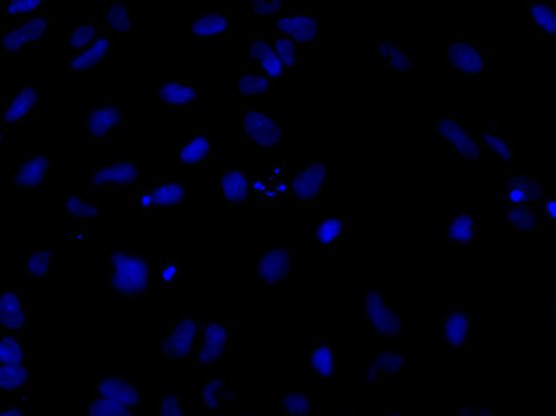 CIL: 54783, Homo sapiens, SBAD2 human iPSC line