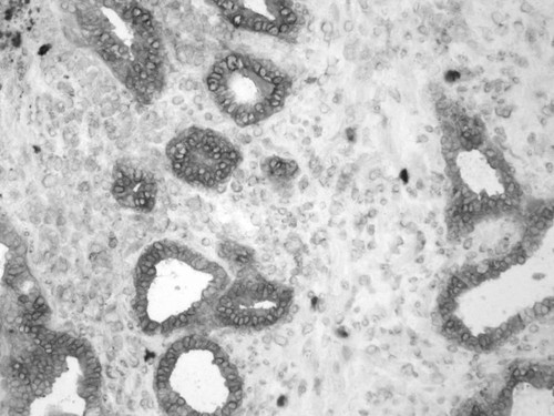 CIL:33552, Homo sapiens, endocrine-paracrine cell of prostate gland, basal cell of prostate epithelium, luminal cell of prostate epithelium, blood vessel endothelial cell, perineural cell, sheath cell, leukocyte, prostate stromal cell, smooth muscle cell of prostate