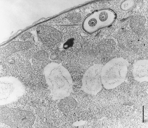 CIL:12105, Colpoda cucullus, cell by organism, eukaryotic cell, Eukaryotic Protist, Ciliated Protist