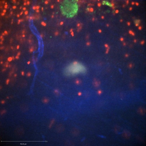 CIL:47309, Staphylococcus aureus, neutrophil, endothelial cell