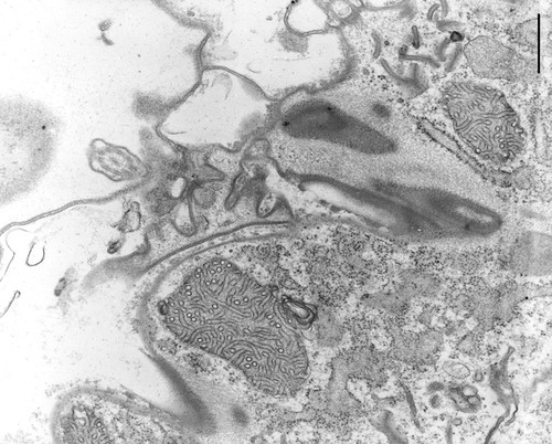 CIL:9697, Coleps hirtus, eukaryotic cell, Eukaryotic Protist, CIliated Protist