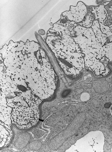 CIL:7625, Nassula, cell by organism, eukaryotic cell, Eukaryotic Protist, Ciliated Protist