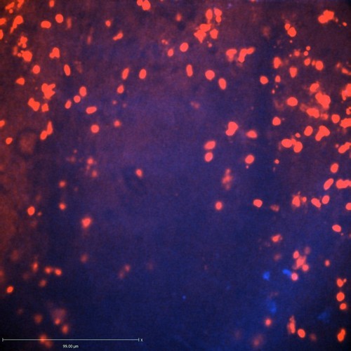 CIL:47307, Staphylococcus aureus, neutrophil, endothelial cell