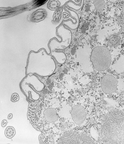 CIL:39157, Paramecium caudatum, cell by organism, eukaryotic cell, Eukaryotic Protist, Ciliated Protist