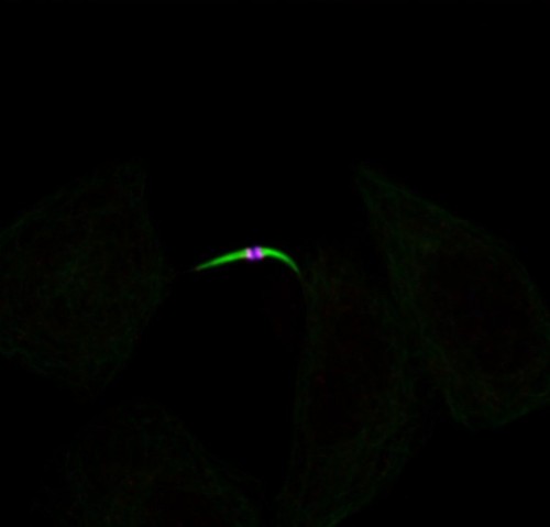 CIL:7242, Homo sapiens, epithelial cell