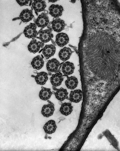 CIL:9705, Euplotes sp., cell by organism, eukaryotic cell, Eukaryotic Protist, Ciliated Protist